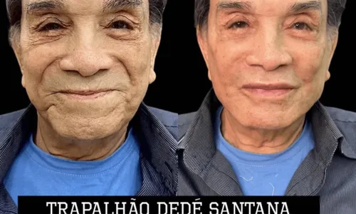 
				
					Aos 86 anos, Dedé Santana faz harmonização facial; veja antes e depois
				
				