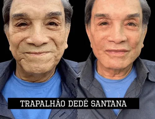 
				
					Aos 86 anos, Dedé Santana faz harmonização facial; veja antes e depois
				
				