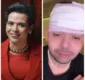 
                  Humorista conhecido por imitar Dilma Rousseff é agredido durante tentativa de assalto