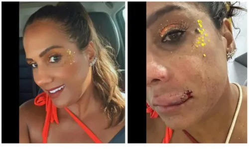 
				
					Imagens mostram mulher sendo agredida com soco na boca em bloco de Bell Marques no carnaval
				
				